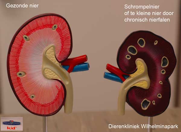 Een gezonde nier en een schrompelnier